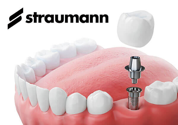 インプラントのイメージ画像、straumann